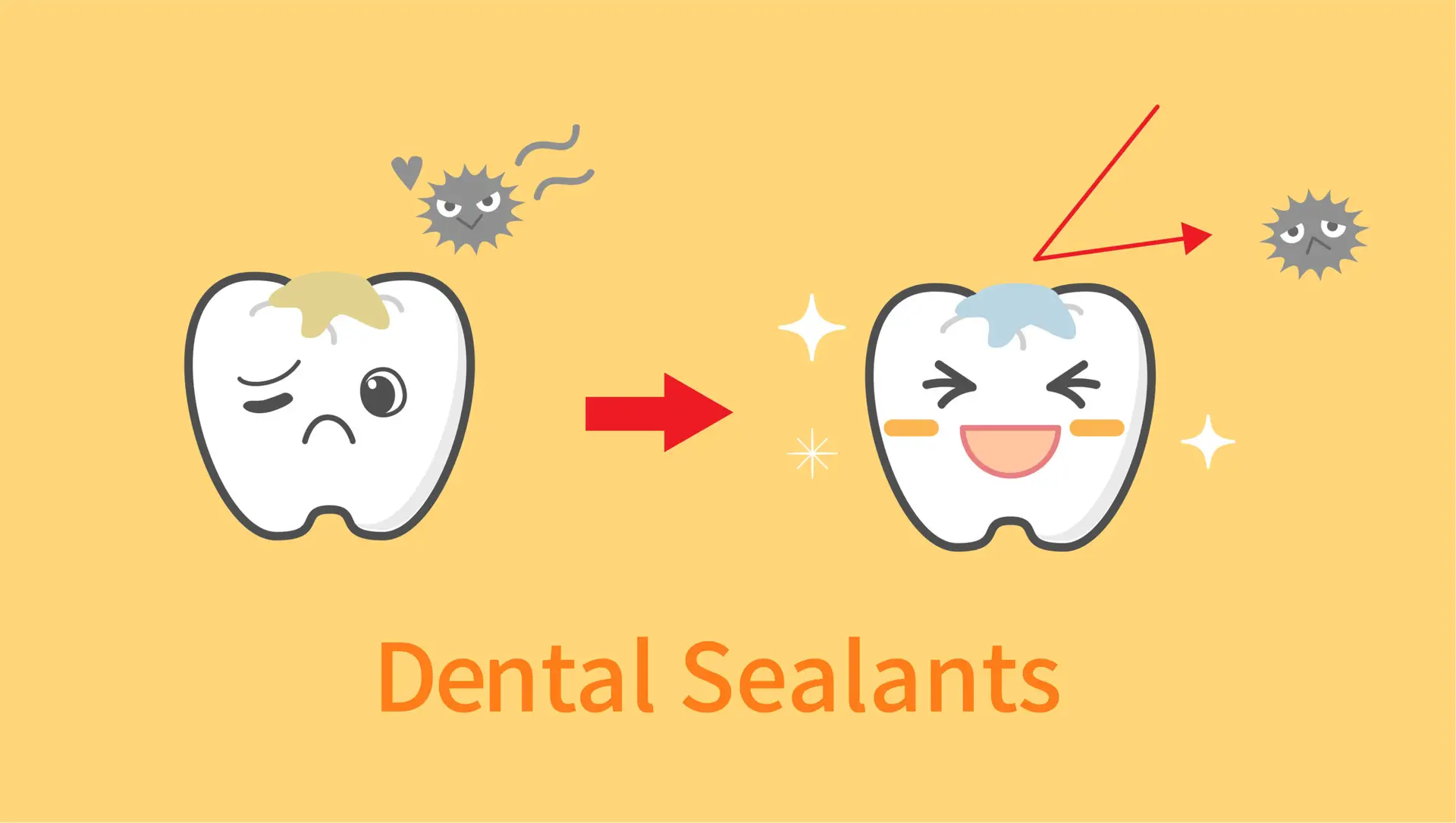 dental sealant for kids illustration